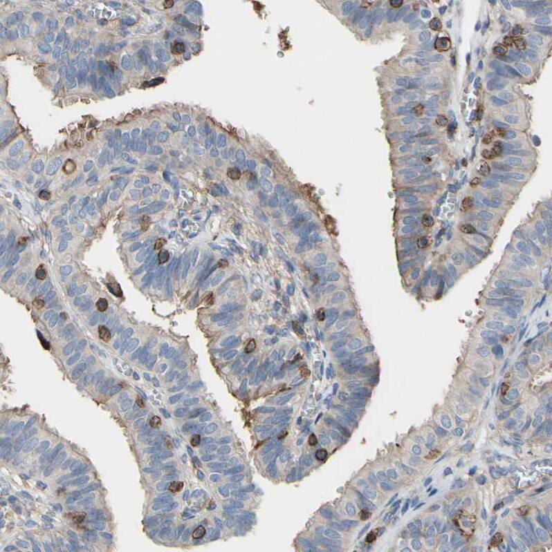 Annexin A6 Antibody - BSA Free Immunohistochemistry: Annexin A6 Antibody - BSA Free [NBP1-90149]