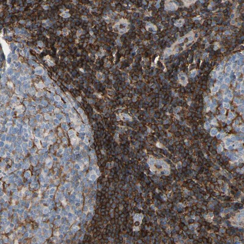 Annexin A6 Antibody - BSA Free Immunohistochemistry: Annexin A6 Antibody - BSA Free [NBP1-90149]