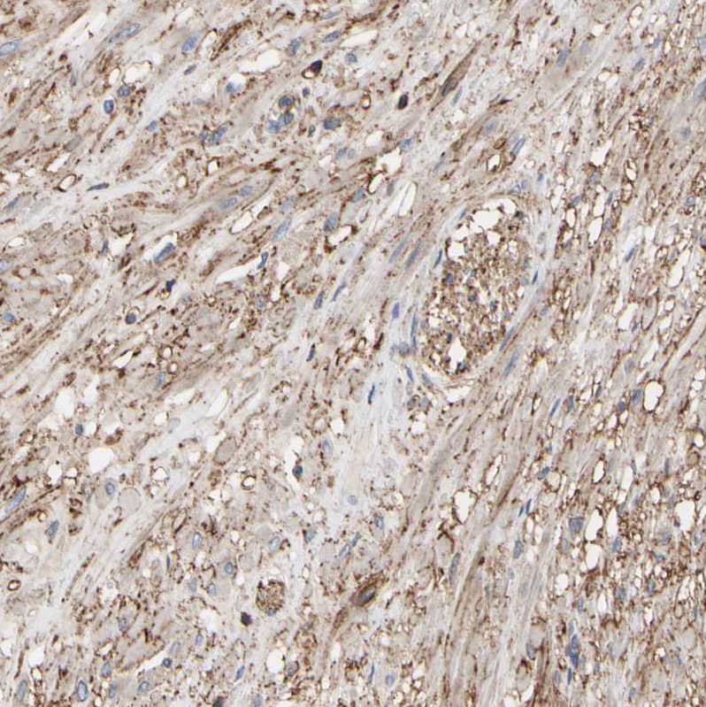 Annexin A6 Antibody - BSA Free Immunohistochemistry: Annexin A6 Antibody - BSA Free [NBP1-90149]
