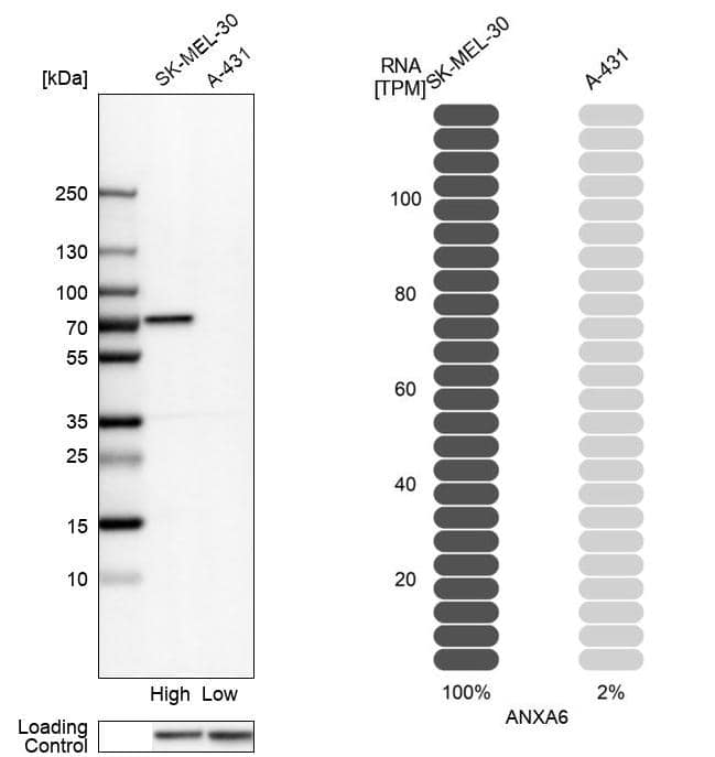 Annexin A6 Antibody - BSA Free Western Blot: Annexin A6 Antibody - BSA Free [NBP1-90149]
