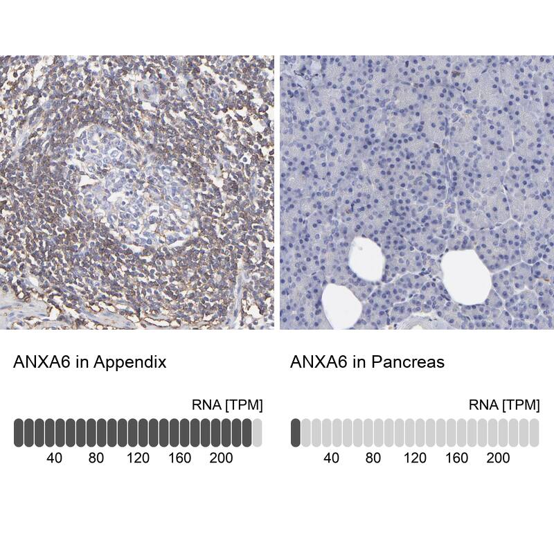 Annexin A6 Antibody - BSA Free Immunohistochemistry: Annexin A6 Antibody - BSA Free [NBP1-90150]