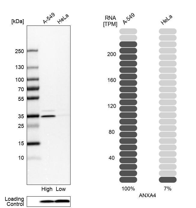 Annexin A4 Antibody - BSA Free Western Blot: Annexin A4 Antibody - BSA Free [NBP1-90151]