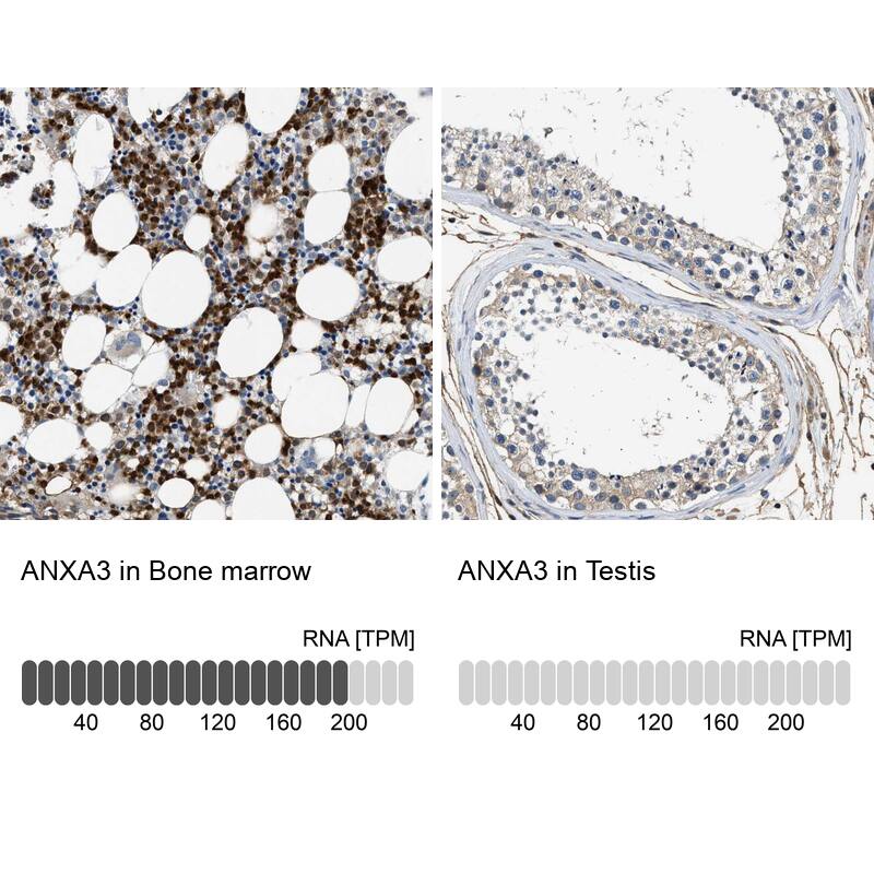 Annexin A3 Antibody - BSA Free Immunohistochemistry: Annexin A3 Antibody - BSA Free [NBP1-90154]