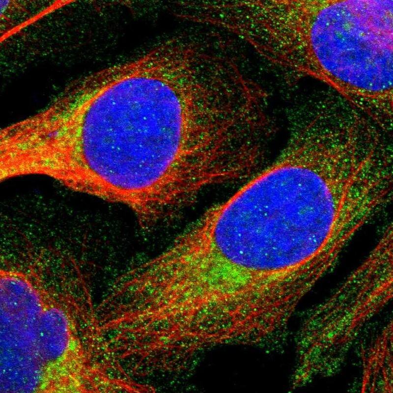 Annexin A3 Antibody - BSA Free Immunocytochemistry/ Immunofluorescence: Annexin A3 Antibody [NBP1-90155]