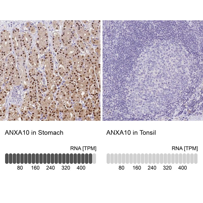 Annexin A10 Antibody - BSA Free Immunohistochemistry: Annexin A10 Antibody - BSA Free [NBP1-90156]