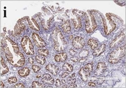 Annexin A10 Antibody