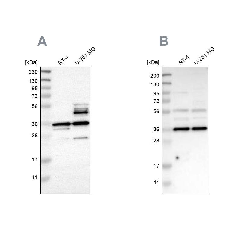 Annexin A13 Antibody - BSA Free Western Blot: Annexin A13 Antibody - BSA Free [NBP1-90157]