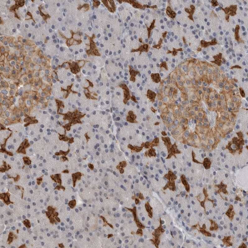 Annexin A11 Antibody - BSA Free Immunohistochemistry: Annexin A11 Antibody - BSA Free [NBP1-90160]