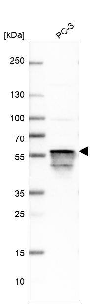 Annexin A11 Antibody - BSA Free Western Blot: Annexin A11 Antibody - BSA Free [NBP1-90160]