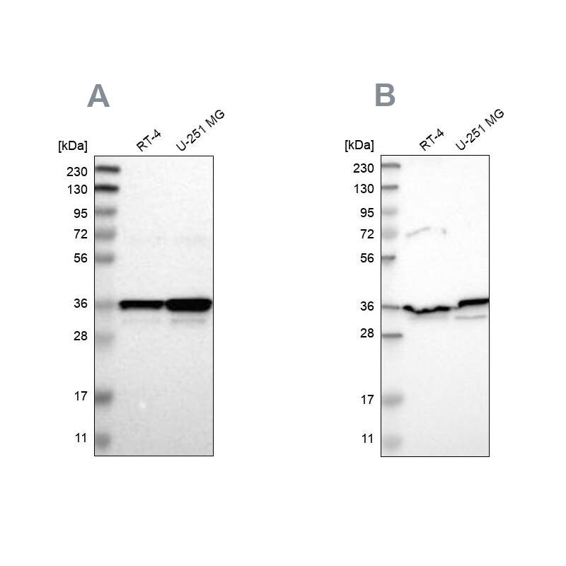 Annexin A1 Antibody - BSA Free Western Blot: Annexin A1 Antibody - BSA Free [NBP1-90161]