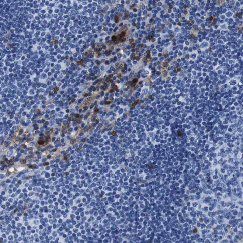 Annexin A1 Antibody - BSA Free Immunohistochemistry: Annexin A1 Antibody - BSA Free [NBP1-90161]