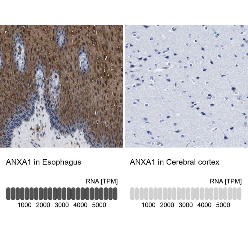 Annexin A1 Antibody - BSA Free Immunohistochemistry: Annexin A1 Antibody - BSA Free [NBP1-90162]