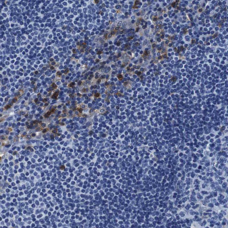 Annexin A1 Antibody - BSA Free Immunohistochemistry: Annexin A1 Antibody - BSA Free [NBP1-90162]
