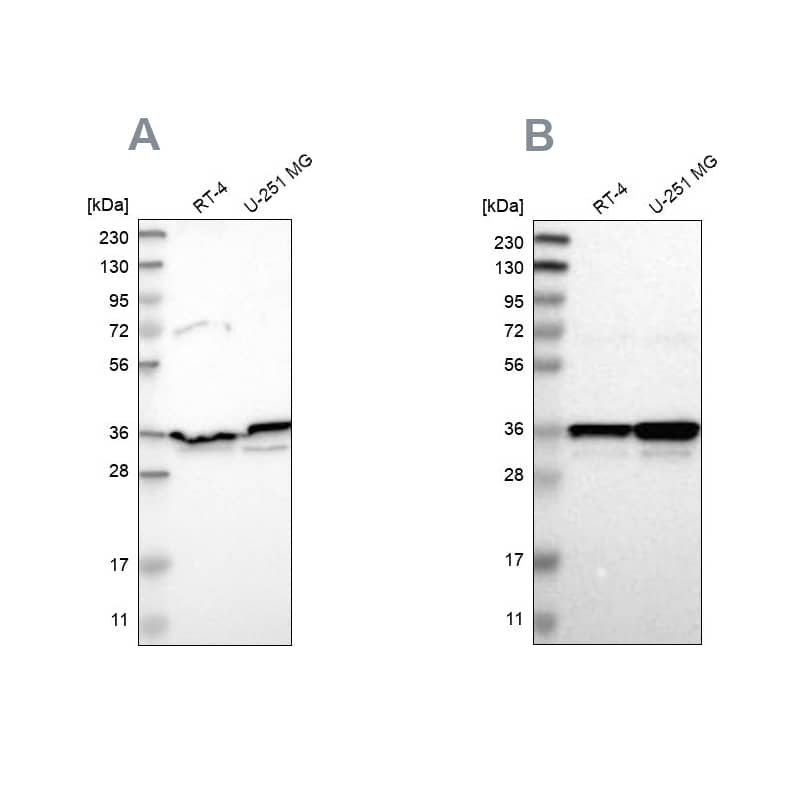Annexin A1 Antibody - BSA Free Western Blot: Annexin A1 Antibody - BSA Free [NBP1-90162]