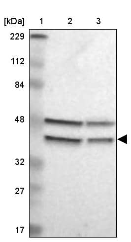 GPANK1/BAT4 Antibody - BSA Free Western Blot: GPANK1/BAT4 Antibody - BSA Free [NBP1-90165]
