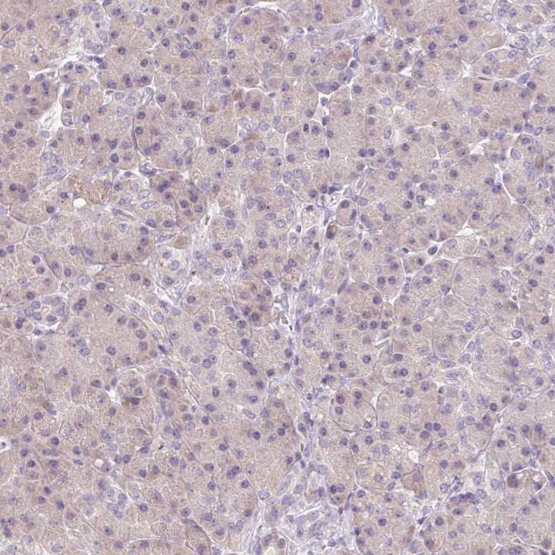 A-Myb Antibody - BSA Free Immunohistochemistry: A-Myb Antibody - BSA Free [NBP1-90171]