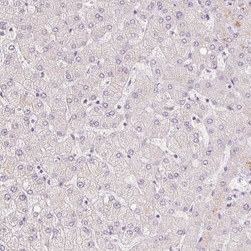 A-Myb Antibody - BSA Free Immunohistochemistry: A-Myb Antibody - BSA Free [NBP1-90171]