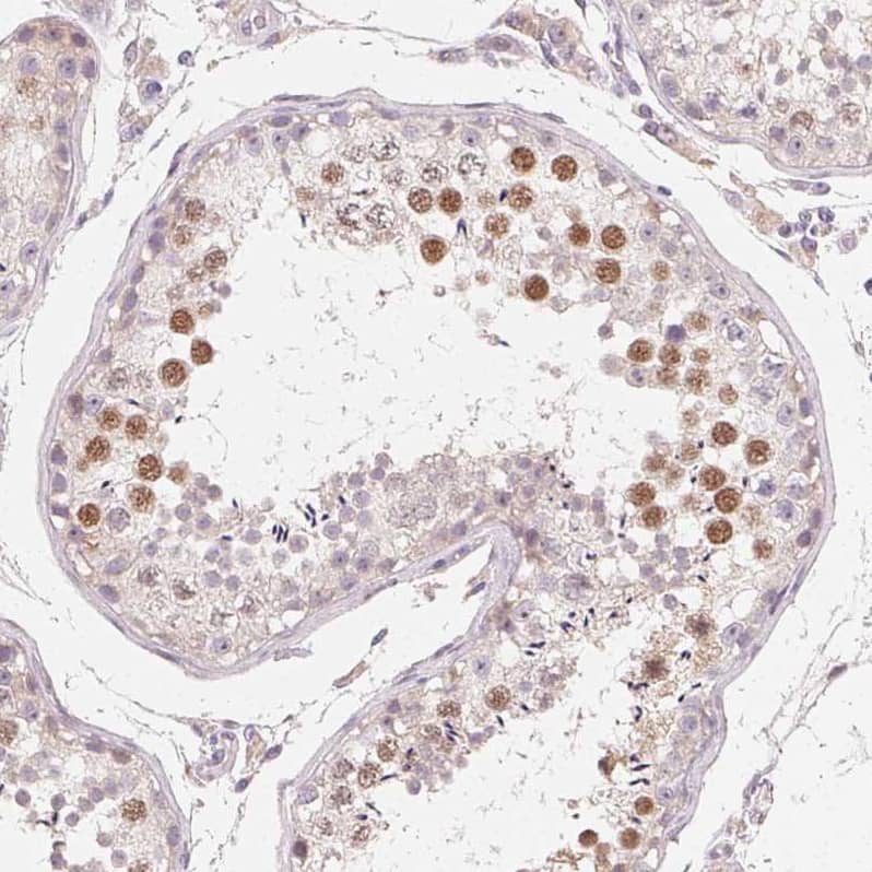 A-Myb Antibody - BSA Free Immunohistochemistry: A-Myb Antibody - BSA Free [NBP1-90171]