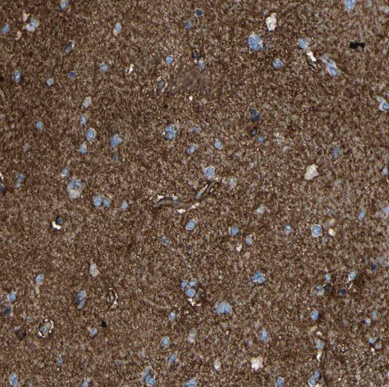 ATPase Na+/K+ beta 2 Antibody - BSA Free Immunohistochemistry: ATPase Na+/K+ beta 2 Antibody - BSA Free [NBP1-90174]