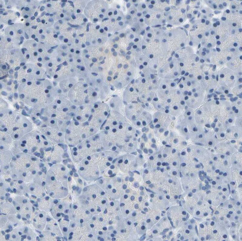 ATPase Na+/K+ beta 2 Antibody - BSA Free Immunohistochemistry: ATPase Na+/K+ beta 2 Antibody - BSA Free [NBP1-90174]