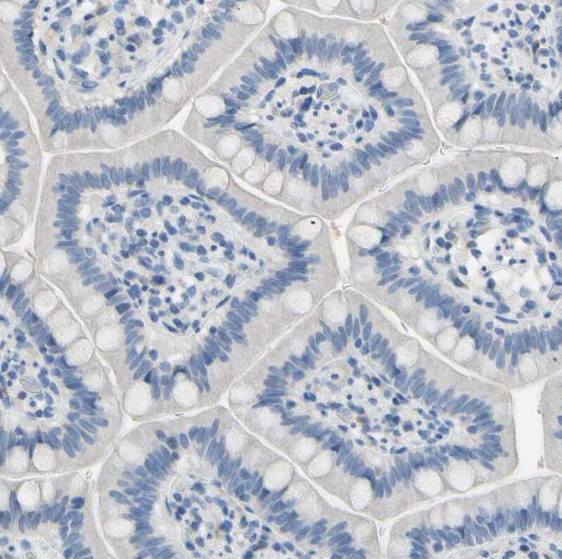 ATPase Na+/K+ beta 2 Antibody - BSA Free Immunohistochemistry: ATPase Na+/K+ beta 2 Antibody - BSA Free [NBP1-90174]