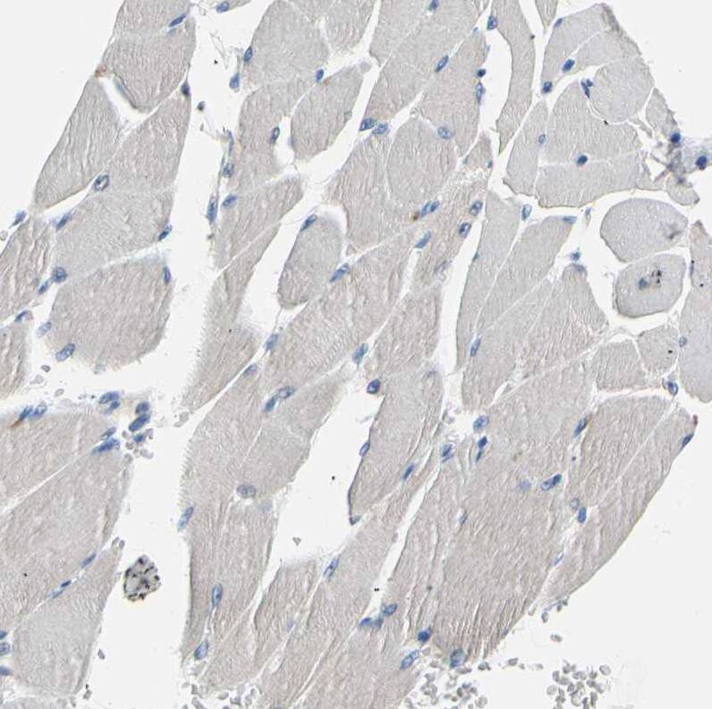 ATPase Na+/K+ beta 2 Antibody - BSA Free Immunohistochemistry: ATPase Na+/K+ beta 2 Antibody - BSA Free [NBP1-90174]