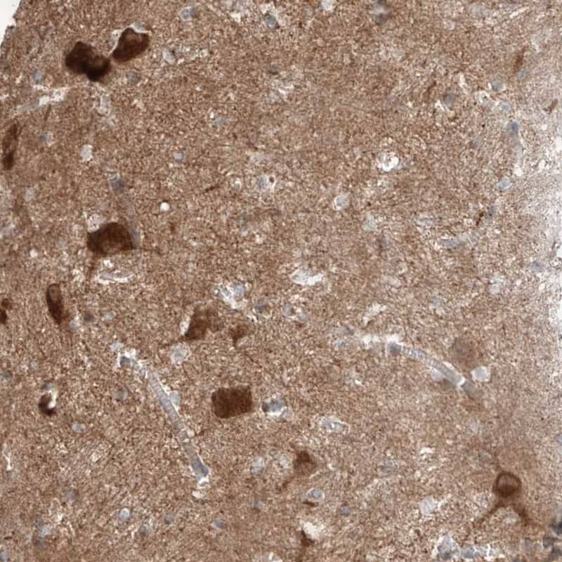 Amisyn Antibody - BSA Free Immunohistochemistry-Paraffin: Amisyn Antibody [NBP1-90175]