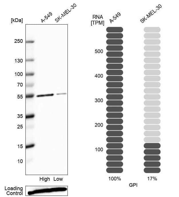 Glucose 6 phosphate isomerase Antibody - BSA Free Western Blot: Glucose 6 phosphate isomerase Antibody - BSA Free [NBP1-90177]