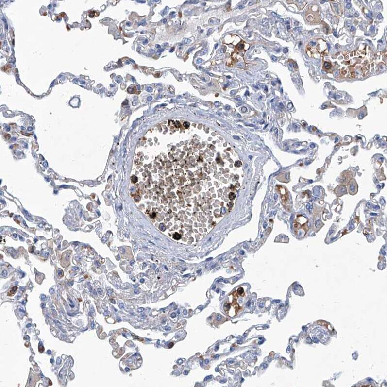FPRL1/FPR2 Antibody - BSA Free Immunohistochemistry: FPRL1/FPR2 Antibody - BSA Free [NBP1-90180]