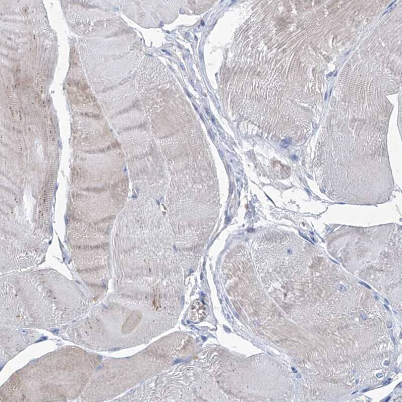 FPRL1/FPR2 Antibody - BSA Free Immunohistochemistry: FPRL1/FPR2 Antibody - BSA Free [NBP1-90180]