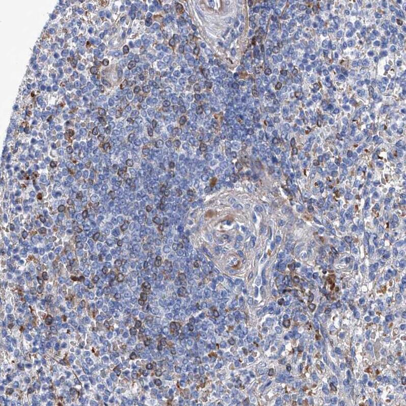 FPRL1/FPR2 Antibody - BSA Free Immunohistochemistry: FPRL1/FPR2 Antibody - BSA Free [NBP1-90180]