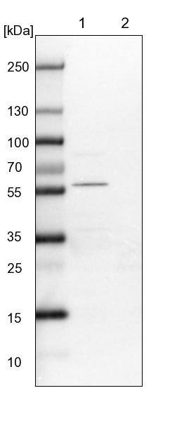 ALS2CR2 Antibody - BSA Free Western Blot: ALS2CR2 Antibody - BSA Free [NBP1-90183]