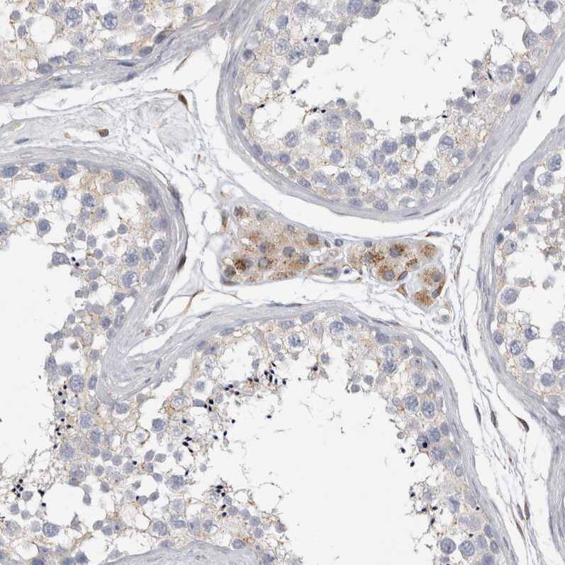 ALS2CR2 Antibody - BSA Free Immunohistochemistry: ALS2CR2 Antibody - BSA Free [NBP1-90183]