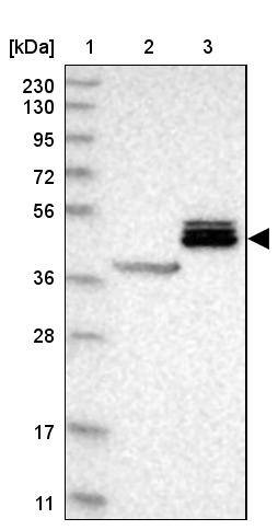 ALS2CR2 Antibody - BSA Free Western Blot: ALS2CR2 Antibody - BSA Free [NBP1-90183]