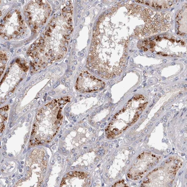 ALS2CR2 Antibody - BSA Free Immunohistochemistry: ALS2CR2 Antibody - BSA Free [NBP1-90183]