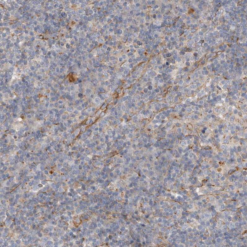 ALS2CR2 Antibody - BSA Free Immunohistochemistry: ALS2CR2 Antibody - BSA Free [NBP1-90183]