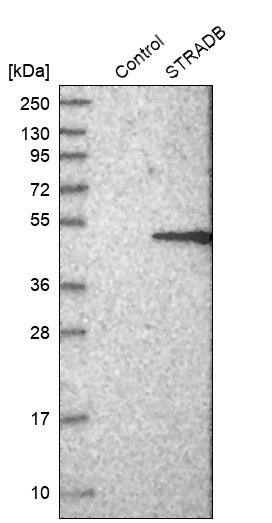 ALS2CR2 Antibody - BSA Free Western Blot: ALS2CR2 Antibody - BSA Free [NBP1-90184]