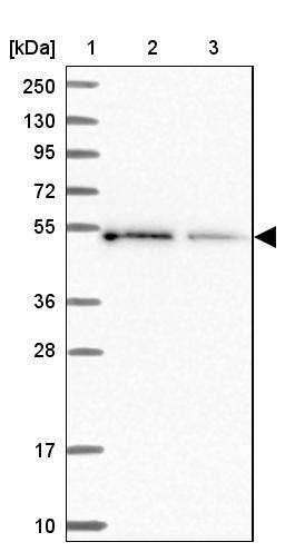 ALS2CR15 Antibody - BSA Free Western Blot: ALS2CR15 Antibody - BSA Free [NBP1-90185]