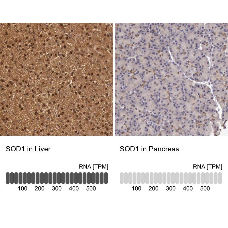 SOD1/Cu-Zn SOD Antibody - BSA Free Immunohistochemistry: SOD1/Cu-Zn SOD Antibody - BSA Free [NBP1-90186]