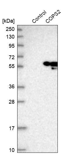 COP9 signalosome complex subunit 2 Antibody - BSA Free Western Blot: COP9 signalosome complex subunit 2 Antibody - BSA Free [NBP1-90189]