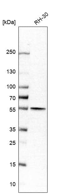 Aldehyde dehydrogenase 5 Antibody - BSA Free Western Blot: Aldehyde dehydrogenase 5 Antibody - BSA Free [NBP1-90192]