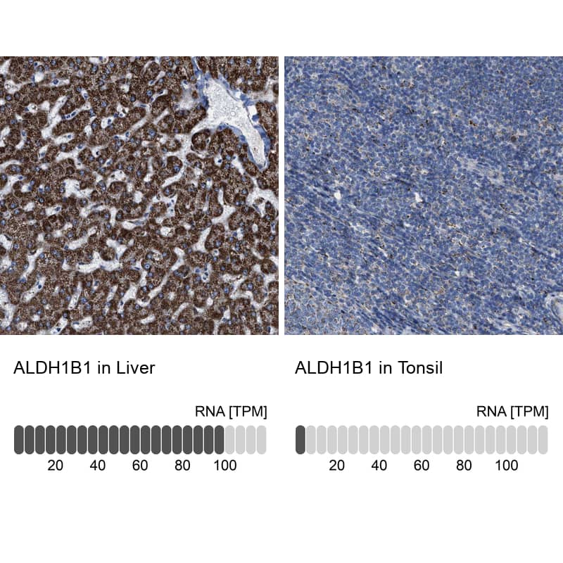 Aldehyde dehydrogenase 5 Antibody - BSA Free Immunohistochemistry: Aldehyde dehydrogenase 5 Antibody - BSA Free [NBP1-90192]