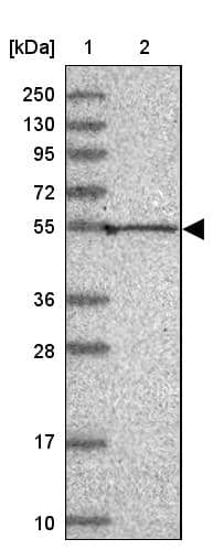 Pan KvBeta Antibody - BSA Free Western Blot: Pan KvBeta Antibody - BSA Free [NBP1-90194]