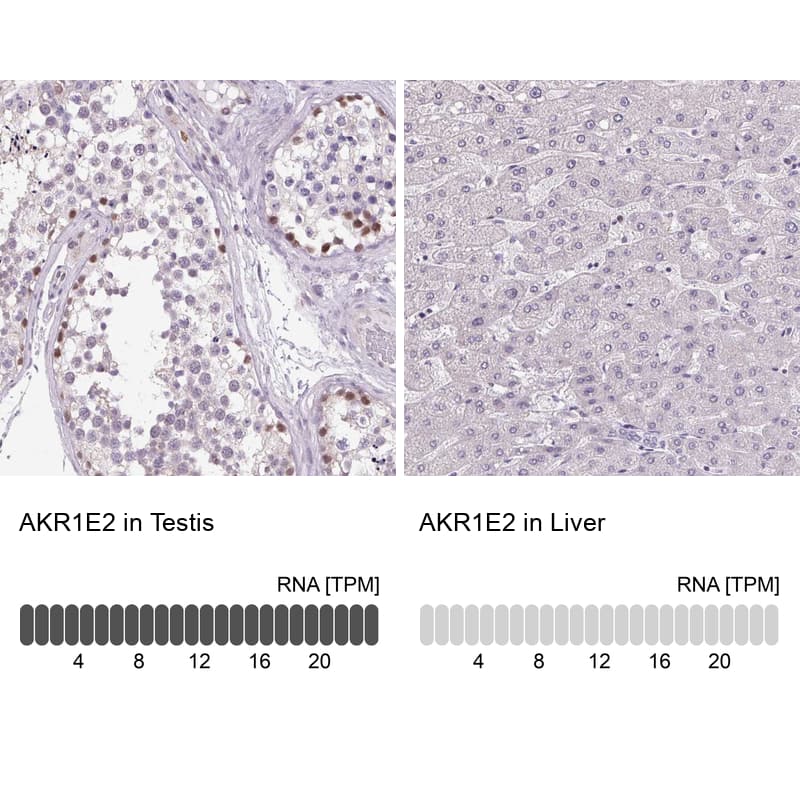 AKR1CL2 Antibody - BSA Free Immunohistochemistry: AKR1CL2 Antibody - BSA Free [NBP1-90195]