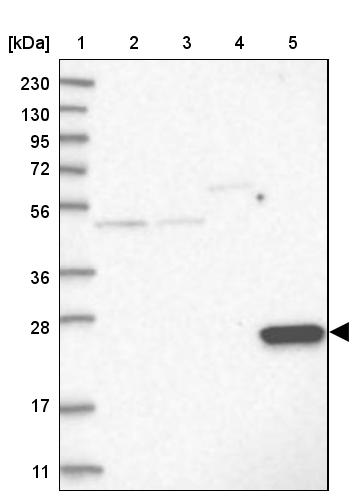 AKR1CL2 Antibody - BSA Free Western Blot: AKR1CL2 Antibody - BSA Free [NBP1-90195]