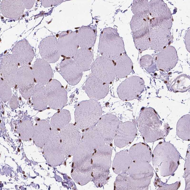 AKAP95/AKAP8 Antibody - BSA Free Immunohistochemistry: AKAP95/AKAP8 Antibody - BSA Free [NBP1-90196]