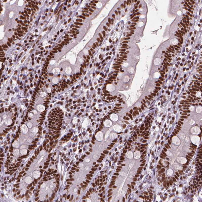 AKAP95/AKAP8 Antibody - BSA Free Immunohistochemistry: AKAP95/AKAP8 Antibody - BSA Free [NBP1-90196]
