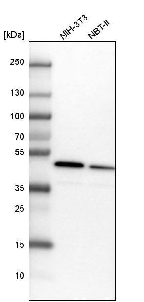 ADK Antibody - BSA Free Western Blot: ADK Antibody - BSA Free [NBP1-90197]