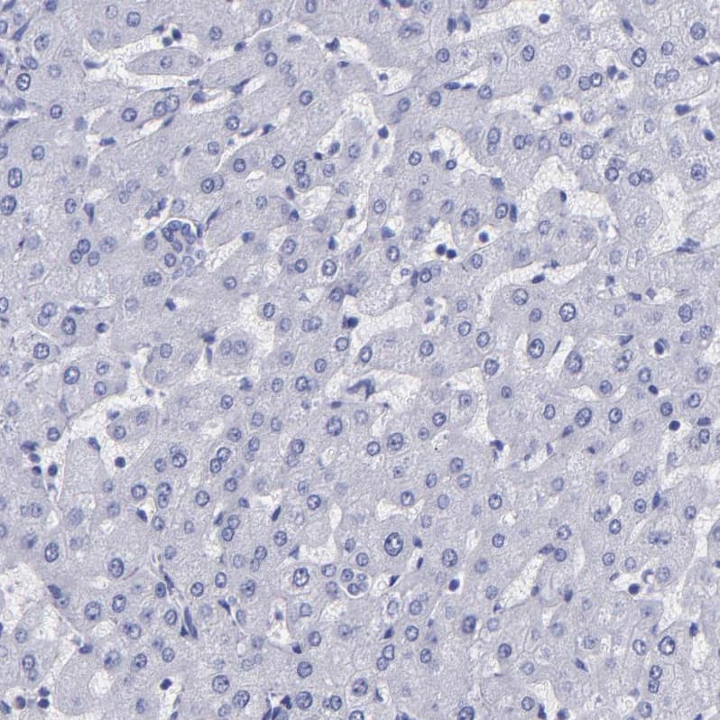 Thyroglobulin Antibody - BSA Free Immunohistochemistry: Thyroglobulin Antibody - BSA Free [NBP1-90200]
