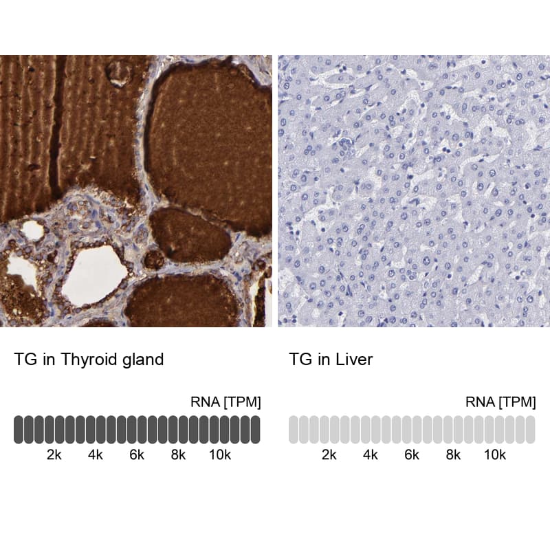 Thyroglobulin Antibody - BSA Free Immunohistochemistry: Thyroglobulin Antibody - BSA Free [NBP1-90200]